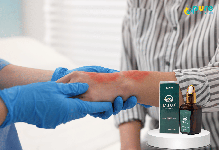 7 Lý do mỗi gia đình nên có một chai dầu mù u M.U.U trong tủ thuốc