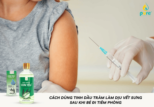 Cách dùng tinh dầu tràm làm dịu vết sưng sau khi bé đi tiêm phòng