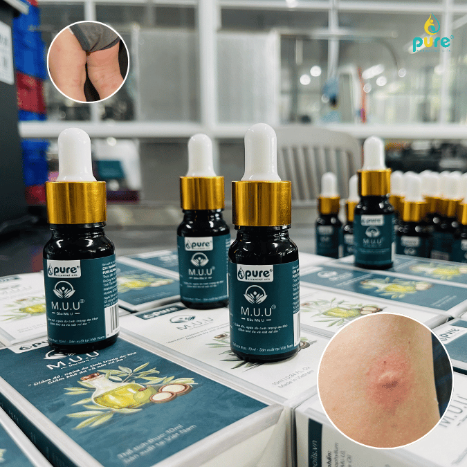 Tại sao Dầu mù u M.U.U là vật bất ly thân trong giỏ đồ đi sinh của mẹ?